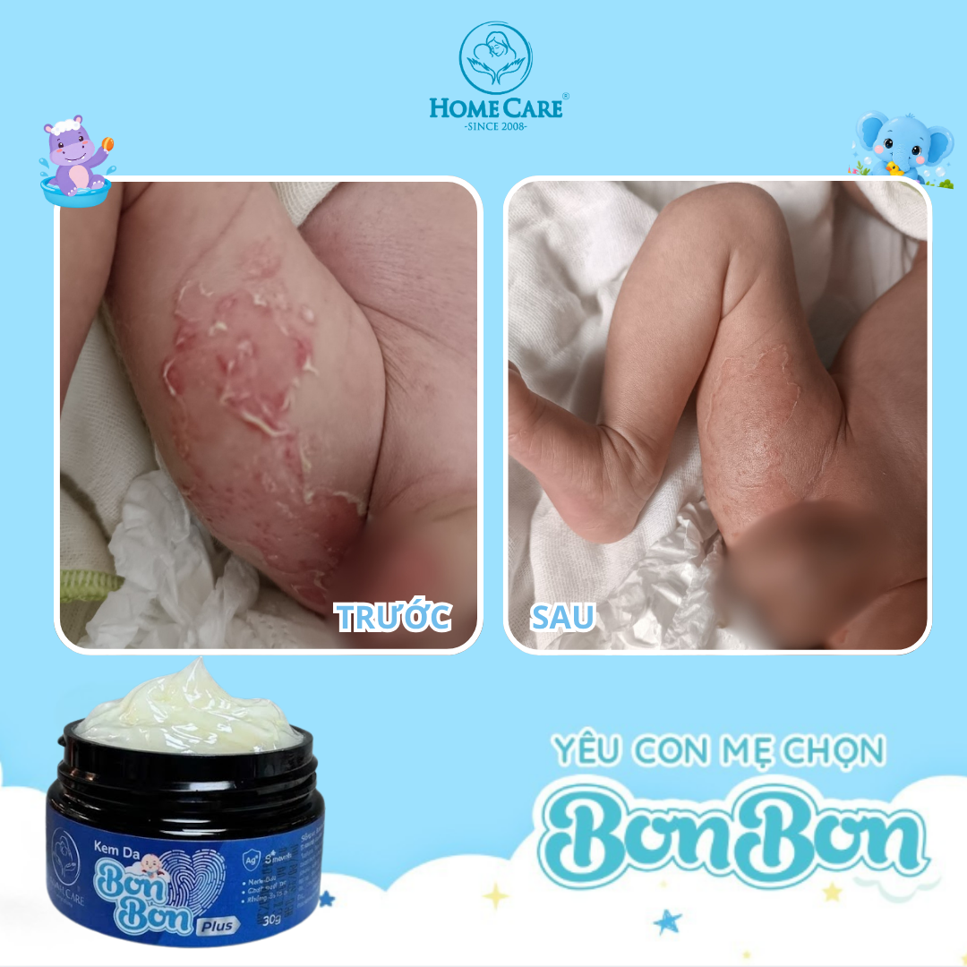 Ảnh feedback từ Thu Trang (Mẹ Bắp)
